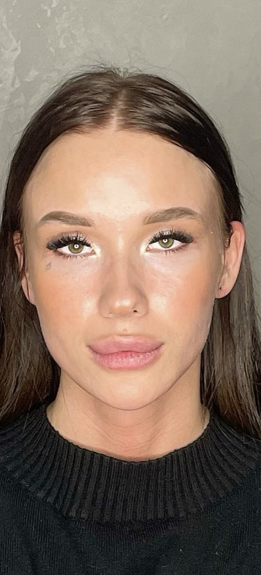 После лечения